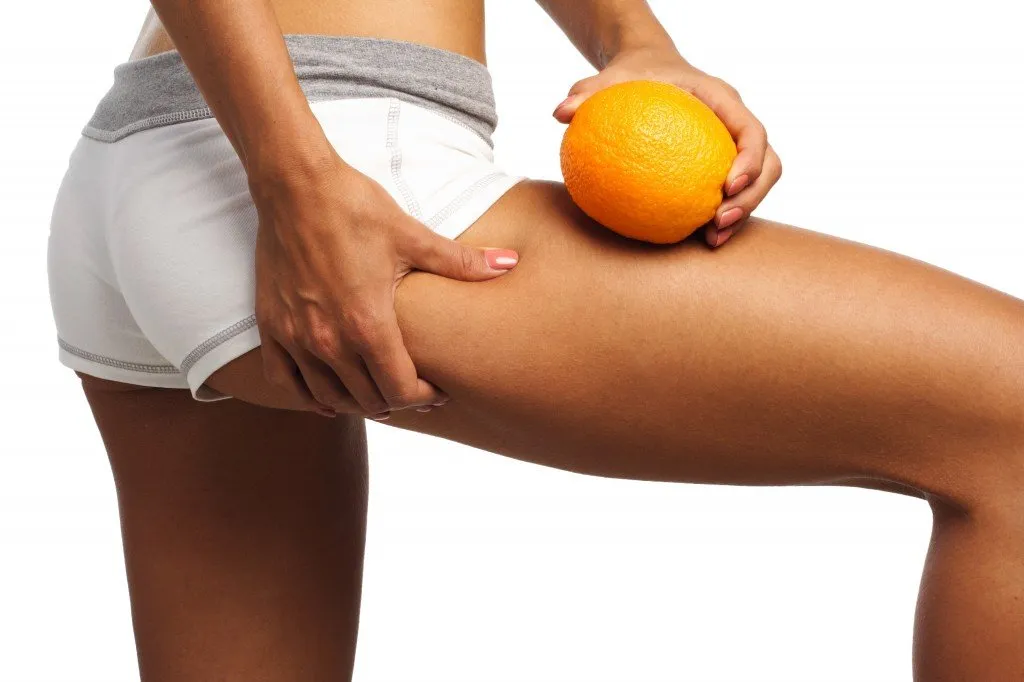 What-causes-cellulite-1024×682